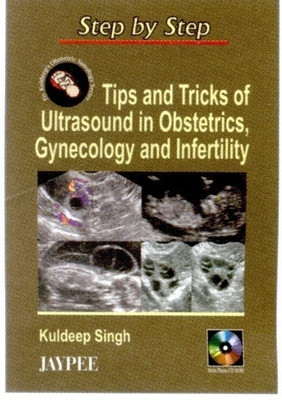 Step by Step: Tips & Tricks of Ultrasound in Obstetrics, Gynecology & Infertility(English, Paperback, Singh Kuldeep)