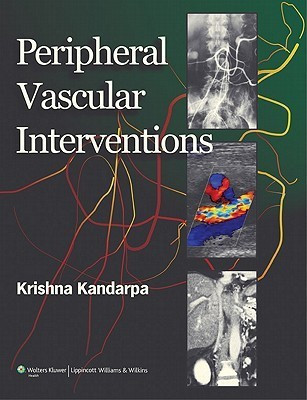 Peripheral Vascular Interventions(English, Hardcover, unknown)