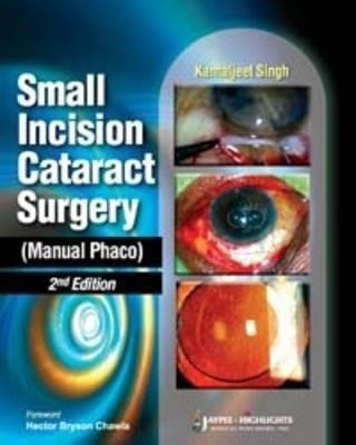 Small Incision Cataract Surgery (Manual Phaco)(English, Paperback, Singh Kamaljeet)