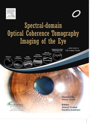 Spectral-domain Optical Coherence Tomography Imaging of the Eye(English, Hardcover, Vinekar Anand)