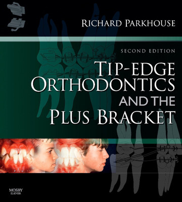 Tip-Edge Orthodontics and the Plus Bracket(English, Hardcover, Parkhouse Richard)