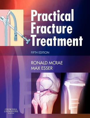 Practical Fracture Treatment(English, Paperback, McRae Ronald)