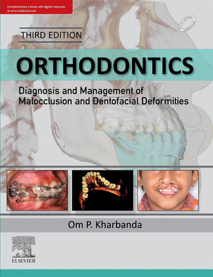 Orthodontics: Diagnosis and Management of Malocclusion and Dentofacial Deformities(English, Hardcover, Kharbanda Om Prakash)