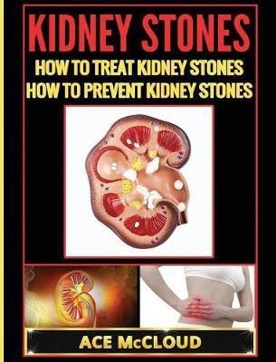 Kidney Stones(English, Hardcover, McCloud Ace)