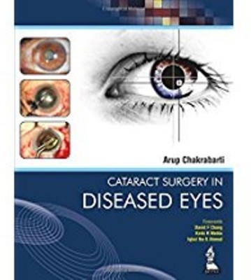 Cataract Surgery in Diseased Eyes(English, Hardcover, Chakrabarti Arup)