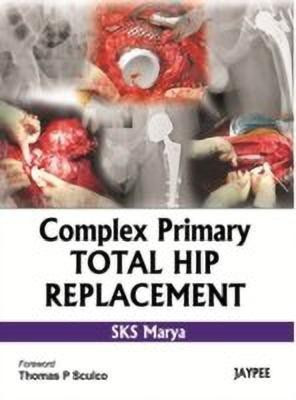 Complex Primary Total Hip Replacement(English, Hardcover, Marya SKS)