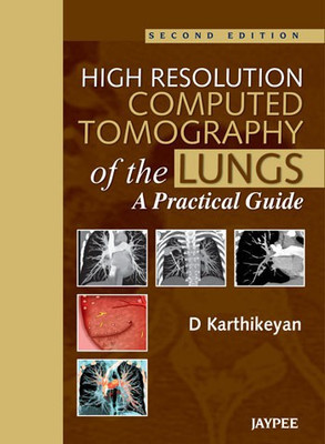 High Resolution Computed Tomography of the Lungs: A Practical Guide 2nd  Edition(English, Hardcover, Karthikeyan D)