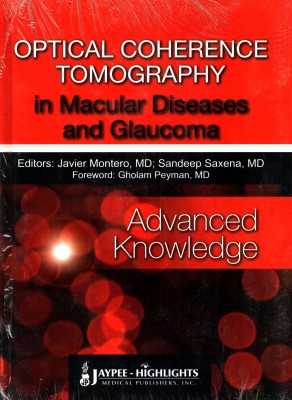 Optical Coherence Tomography in Macular Diseases and Glaucoma: Advanced Knowledge(English, Hardcover, Montero Javier)