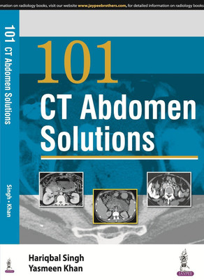 101 CT Abdomen Solutions(English, Paperback, Singh Hariqbal)