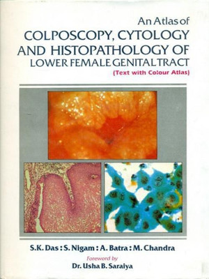 An Atlas of Colposcopy, Cytology & Histopathology of Lower Female Genital Tract(English, Hardcover, Das S.K.)