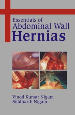 Essentials of Abdominal Wall Hernias(English, Hardcover, Nigam V. K.)