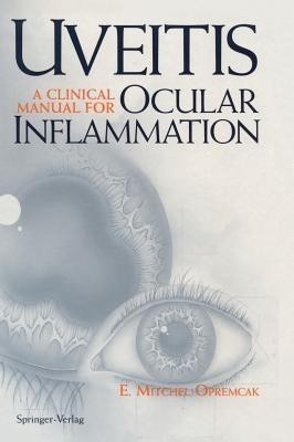 Uveitis  - A Clinical Manual for Ocular Inflammation(English, Hardcover, Opremcak E. Mitchel)