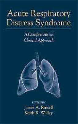 Acute Respiratory Distress Syndrome(English, Paperback, unknown)