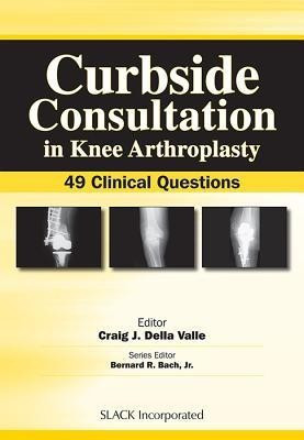 Curbside Consultation in Knee Arthroplasty(English, Paperback, unknown)