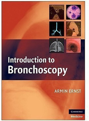 Introduction to Bronchoscopy(English, Paperback, unknown)