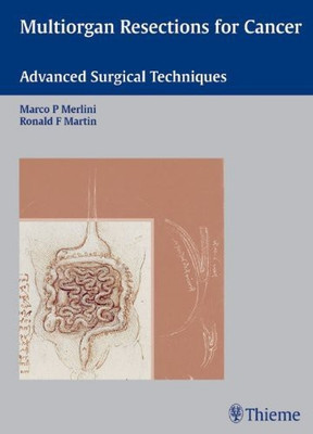 Multiorgan Resections for Cancer(English, Hardcover, unknown)