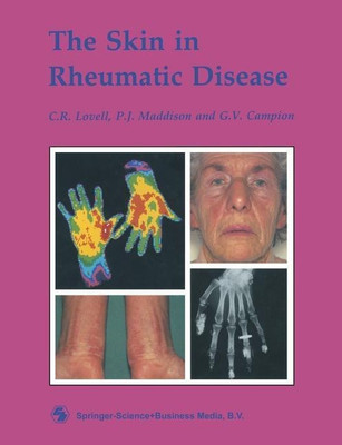 The Skin in Rheumatic Disease(English, Paperback, Lovell C. R.)