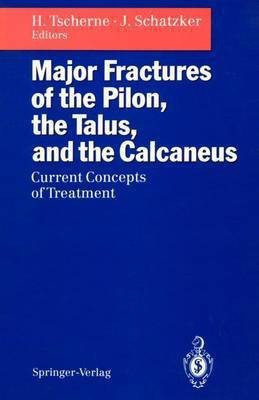 Major Fractures of the Pilon, the Talus, and the Calcaneus(English, Paperback, unknown)