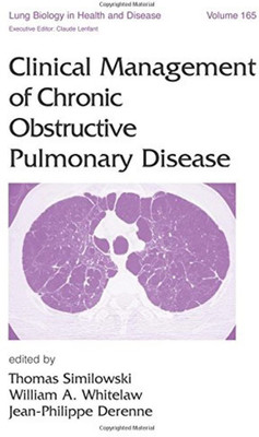 Clinical Management of Chronic Obstructive Pulmonary Disease(English, Hardcover, unknown)