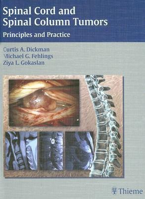 Spinal Cord and Spinal Column Tumors(English, Hardcover, unknown)
