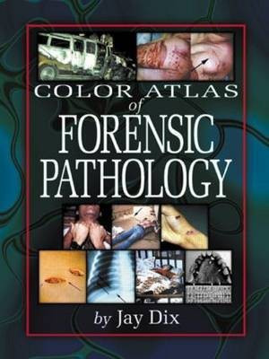 Color Atlas Of Forensic Pathology(English, Hardcover, Dix Jay)