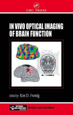 In Vivo Optical Imaging of Brain Function(English, Hardcover, unknown)