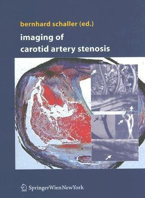 Imaging of Carotid Artery Stenosis(English, Hardcover, unknown)
