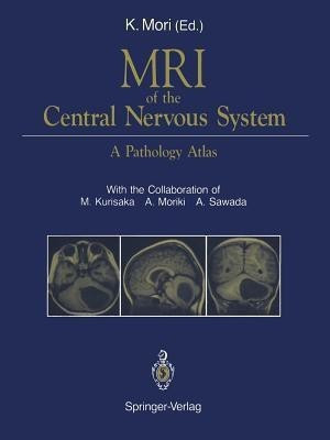 MRI of the Central Nervous System(English, Paperback, unknown)