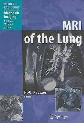 MRI of the Lung(English, Hardcover, unknown)