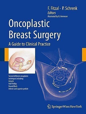 Oncoplastic Breast Surgery(English, Hardcover, unknown)