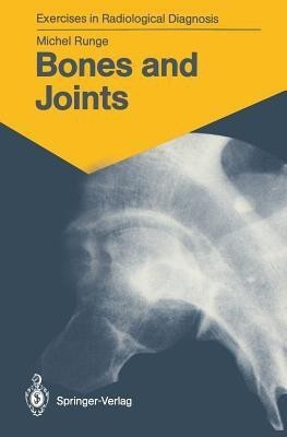 Bones and Joints(English, Paperback, Runge Michel)