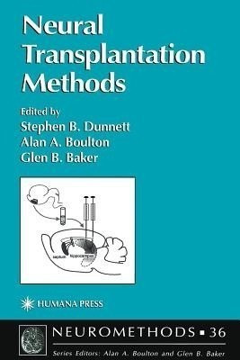 Neural Transplantation Methods(English, Paperback, unknown)
