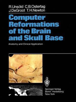 Computer Reformations of the Brain and Skull Base(English, Paperback, Unsoeld R.)