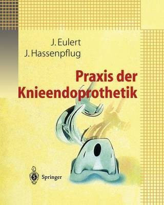 Praxis der Knieendoprothetik(German, Paperback, unknown)