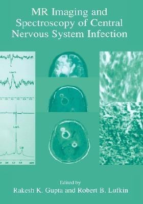 MR Imaging and Spectroscopy of Central Nervous System Infection(English, Hardcover, unknown)