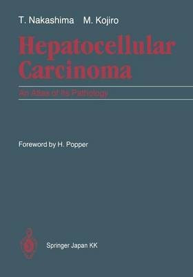 Hepatocellular Carcinoma(English, Paperback, Nakashima Toshiro)