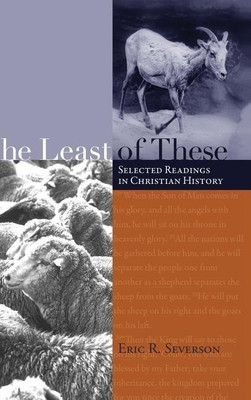 The Least of These(English, Hardcover, Severson Eric R)