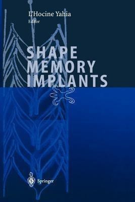 Shape Memory Implants(English, Paperback, unknown)