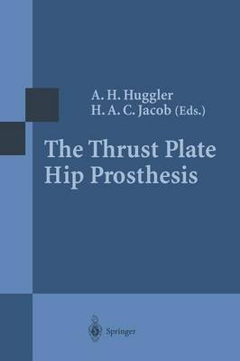 The Thrust Plate Hip Prosthesis(English, Paperback, unknown)