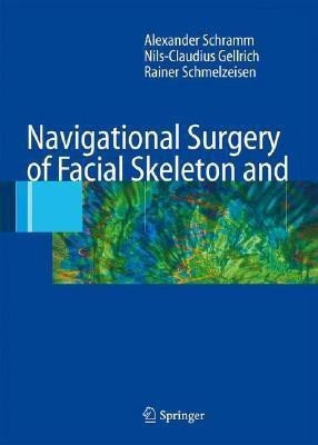 Navigational Surgery of the Facial Skeleton(English, Hardcover, Schramm Alexander)