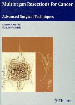 Multiorgan Resections for Cancer(English, Hardcover, Merlini Marco P)