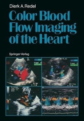 Color Blood Flow Imaging of the Heart(English, Paperback, Redel Dierk A.)