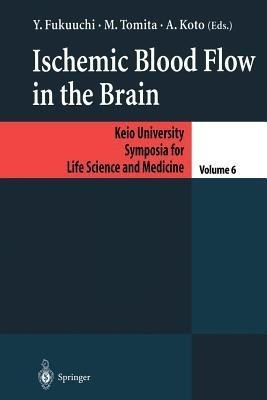 Ischemic Blood Flow in the Brain(English, Paperback, unknown)