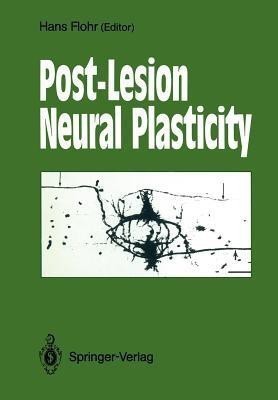 Post-Lesion Neural Plasticity(English, Paperback, unknown)