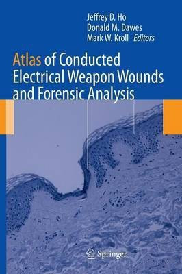 Atlas of Conducted Electrical Weapon Wounds and Forensic Analysis(English, Hardcover, unknown)