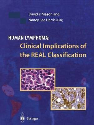 Human Lymphoma: Clinical Implications of the REAL Classification(English, Paperback, unknown)