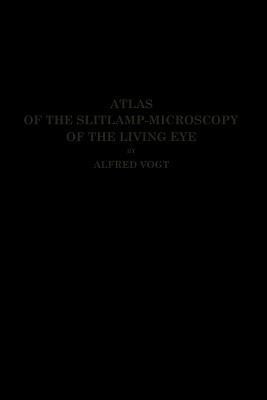 Atlas of the Slitlamp-Microscopy of the Living Eye(English, Paperback, Vogt Alfred)