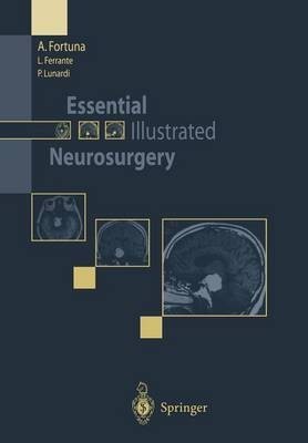 Essential Illustrated Neurosurgery(English, Paperback, Fortuna A.)