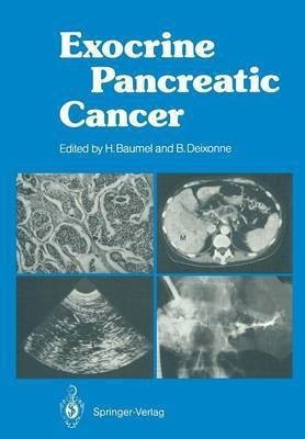 Exocrine Pancreatic Cancer(English, Paperback, unknown)