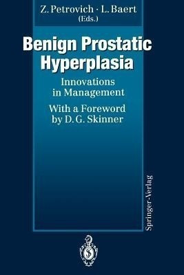 Benign Prostatic Hyperplasia(English, Paperback, unknown)